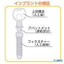 インプラントの構造