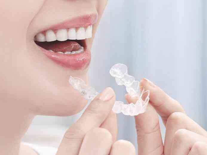 マウスピース矯正 インビザラインgo 京都市左京区のインプラント治療なら いのうえまさとし歯科医院