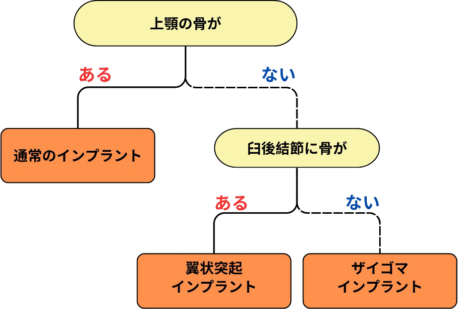 通常インプラント・ザイゴマインプラント・翼状突起インプラントの選び方