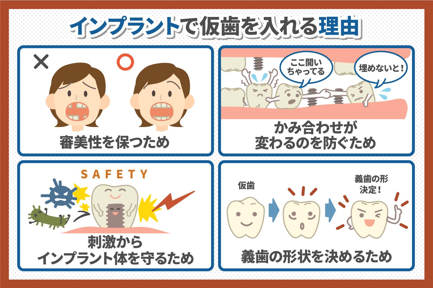 インプラント 仮 歯 いつから