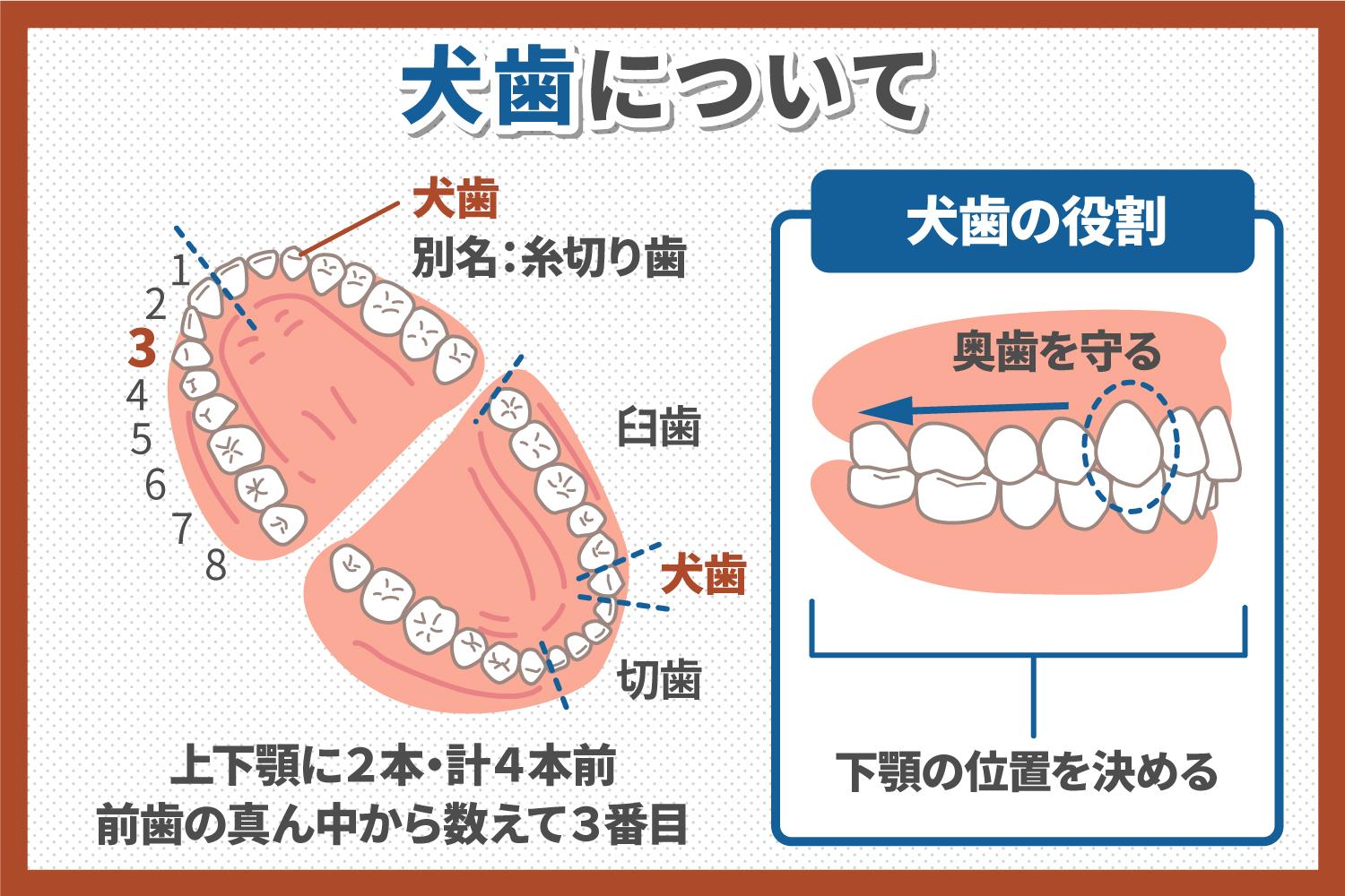 犬歯が抜歯すべきパターンと犬歯のインプラント治療のメリットを解説