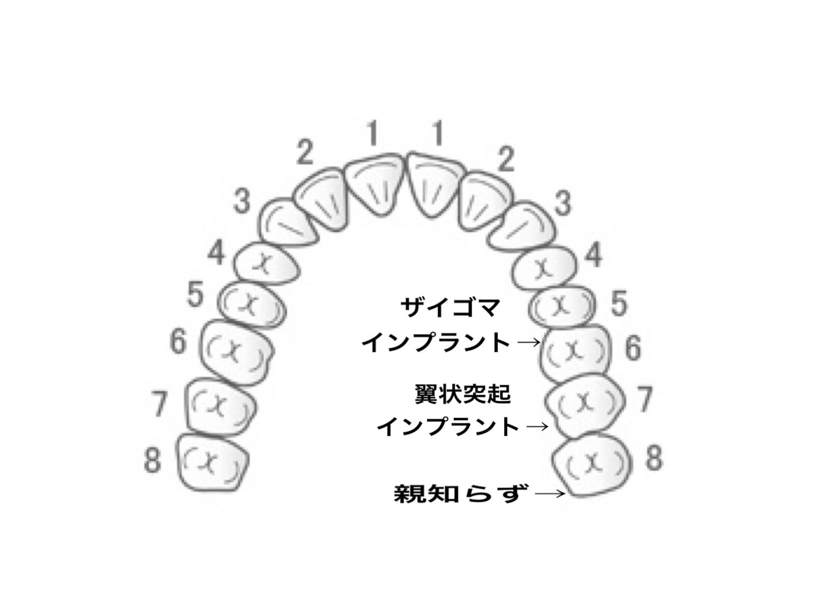 歯の並び